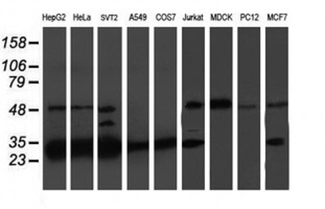 PSMB7 Antibody in Western Blot (WB)