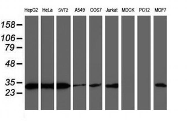 PSMB7 Antibody in Western Blot (WB)