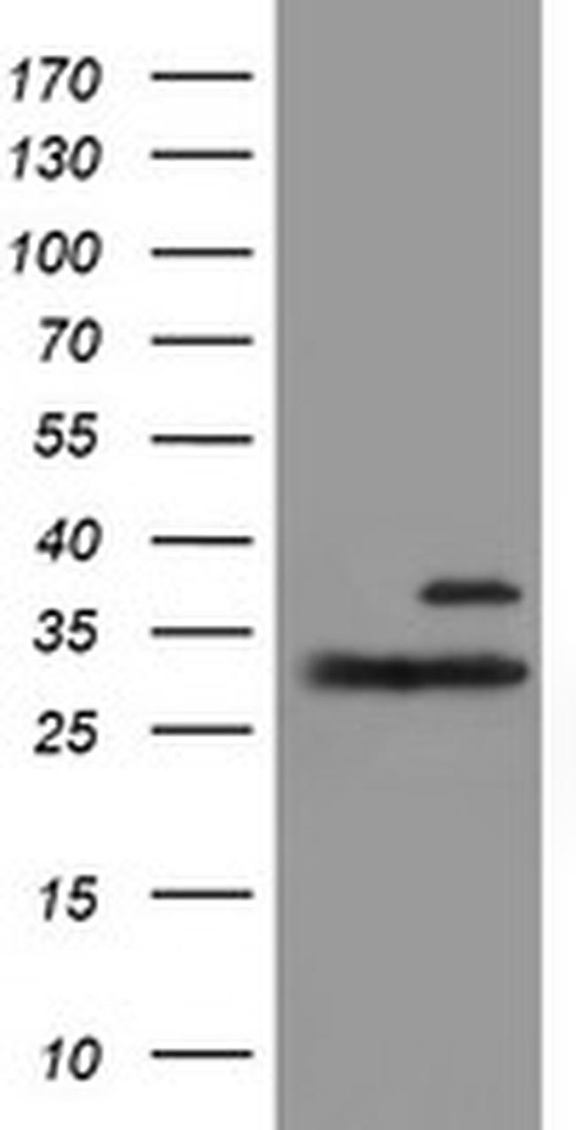 PSMB7 Antibody in Western Blot (WB)