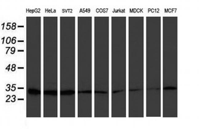 PSMB7 Antibody in Western Blot (WB)