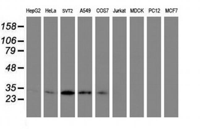 PSMB7 Antibody in Western Blot (WB)