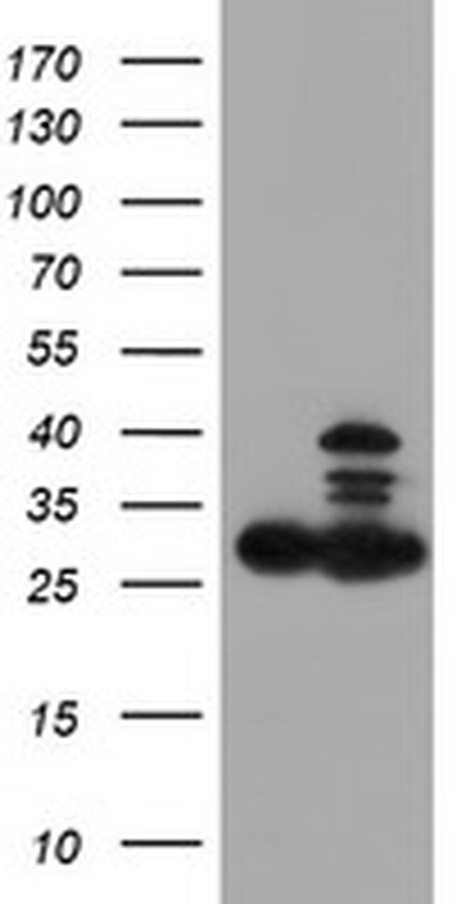 PSMB7 Antibody in Western Blot (WB)