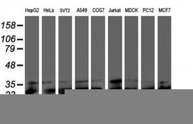 PSMB7 Antibody in Western Blot (WB)