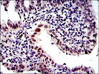 PSMB8 Antibody in Immunohistochemistry (Paraffin) (IHC (P))