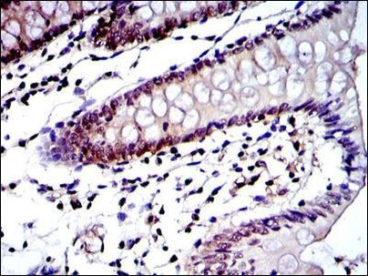 PSMB8 Antibody in Immunohistochemistry (Paraffin) (IHC (P))