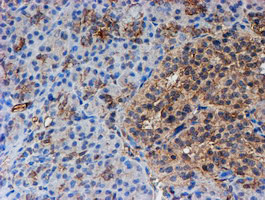 PSMB9 Antibody in Immunohistochemistry (Paraffin) (IHC (P))