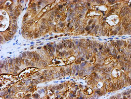 PSMB9 Antibody in Immunohistochemistry (Paraffin) (IHC (P))