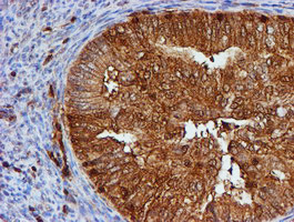 PSMB9 Antibody in Immunohistochemistry (Paraffin) (IHC (P))