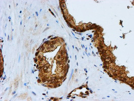 PSMB9 Antibody in Immunohistochemistry (Paraffin) (IHC (P))