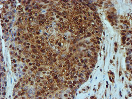 PSMB9 Antibody in Immunohistochemistry (Paraffin) (IHC (P))