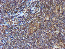 PSMB9 Antibody in Immunohistochemistry (Paraffin) (IHC (P))