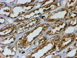 PSMB9 Antibody in Immunohistochemistry (Paraffin) (IHC (P))