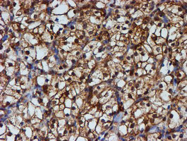 PSMB9 Antibody in Immunohistochemistry (Paraffin) (IHC (P))