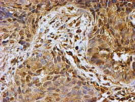 PSMB9 Antibody in Immunohistochemistry (Paraffin) (IHC (P))