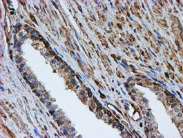 PSMB9 Antibody in Immunohistochemistry (Paraffin) (IHC (P))