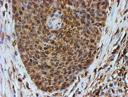 PSMB9 Antibody in Immunohistochemistry (Paraffin) (IHC (P))