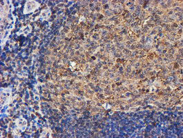 PSMB9 Antibody in Immunohistochemistry (Paraffin) (IHC (P))