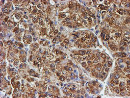 PSMB9 Antibody in Immunohistochemistry (Paraffin) (IHC (P))