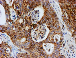 PSMB9 Antibody in Immunohistochemistry (Paraffin) (IHC (P))