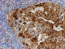 PSMB9 Antibody in Immunohistochemistry (Paraffin) (IHC (P))