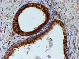 PSMB9 Antibody in Immunohistochemistry (Paraffin) (IHC (P))