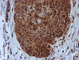 PSMB9 Antibody in Immunohistochemistry (Paraffin) (IHC (P))