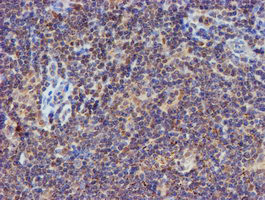 PSMB9 Antibody in Immunohistochemistry (Paraffin) (IHC (P))