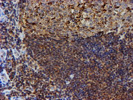 PSMB9 Antibody in Immunohistochemistry (Paraffin) (IHC (P))