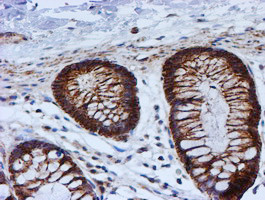 PSMB9 Antibody in Immunohistochemistry (Paraffin) (IHC (P))