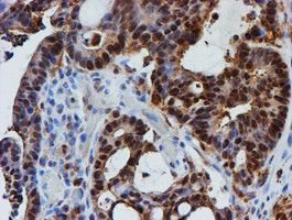 PSMB9 Antibody in Immunohistochemistry (Paraffin) (IHC (P))