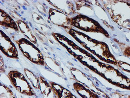 PSMB9 Antibody in Immunohistochemistry (Paraffin) (IHC (P))