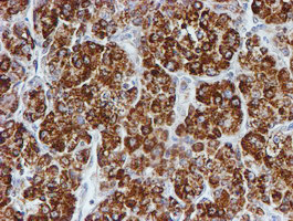 PSMB9 Antibody in Immunohistochemistry (Paraffin) (IHC (P))