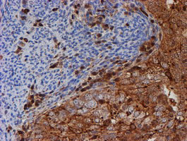 PSMB9 Antibody in Immunohistochemistry (Paraffin) (IHC (P))