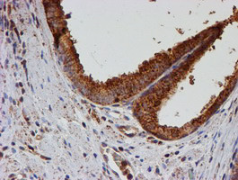 PSMB9 Antibody in Immunohistochemistry (Paraffin) (IHC (P))