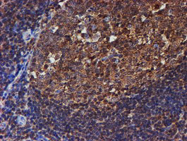 PSMB9 Antibody in Immunohistochemistry (Paraffin) (IHC (P))