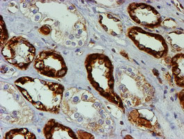 PSMB9 Antibody in Immunohistochemistry (Paraffin) (IHC (P))