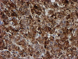 PSMB9 Antibody in Immunohistochemistry (Paraffin) (IHC (P))