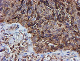 PSMB9 Antibody in Immunohistochemistry (Paraffin) (IHC (P))