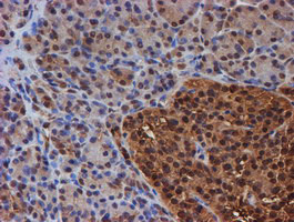 PSMB9 Antibody in Immunohistochemistry (Paraffin) (IHC (P))