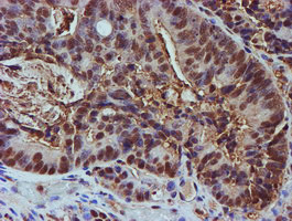 PSMB9 Antibody in Immunohistochemistry (Paraffin) (IHC (P))