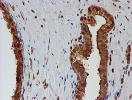 PSMB9 Antibody in Immunohistochemistry (Paraffin) (IHC (P))