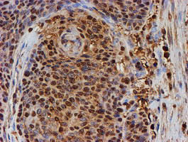 PSMB9 Antibody in Immunohistochemistry (Paraffin) (IHC (P))