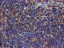 PSMB9 Antibody in Immunohistochemistry (Paraffin) (IHC (P))