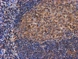 PSMB9 Antibody in Immunohistochemistry (Paraffin) (IHC (P))