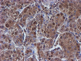 PSMB9 Antibody in Immunohistochemistry (Paraffin) (IHC (P))