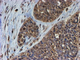 PSMB9 Antibody in Immunohistochemistry (Paraffin) (IHC (P))