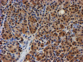 PSMB9 Antibody in Immunohistochemistry (Paraffin) (IHC (P))