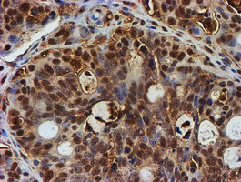 PSMB9 Antibody in Immunohistochemistry (Paraffin) (IHC (P))