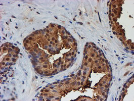 PSMB9 Antibody in Immunohistochemistry (Paraffin) (IHC (P))