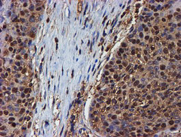 PSMB9 Antibody in Immunohistochemistry (Paraffin) (IHC (P))